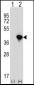 JTV1 Antibody (Center)